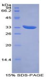 SDS-PAGE (Pink1-1804M).jpg